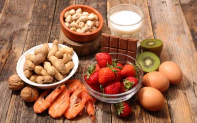 Common Food Allergies and How to Avoid a Reaction