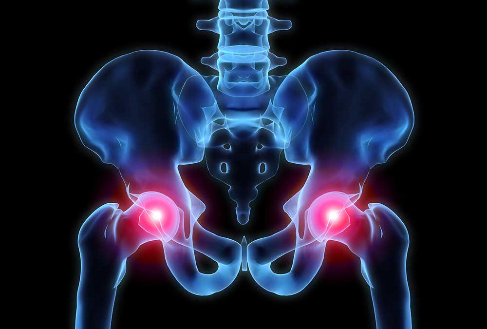 Causes of Hip Pain (and What to Do About It)