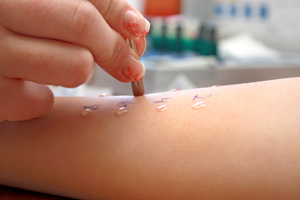 alcat allergy test Atlanta, GA