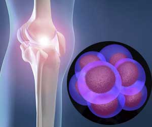 stem cell osteoarthritis