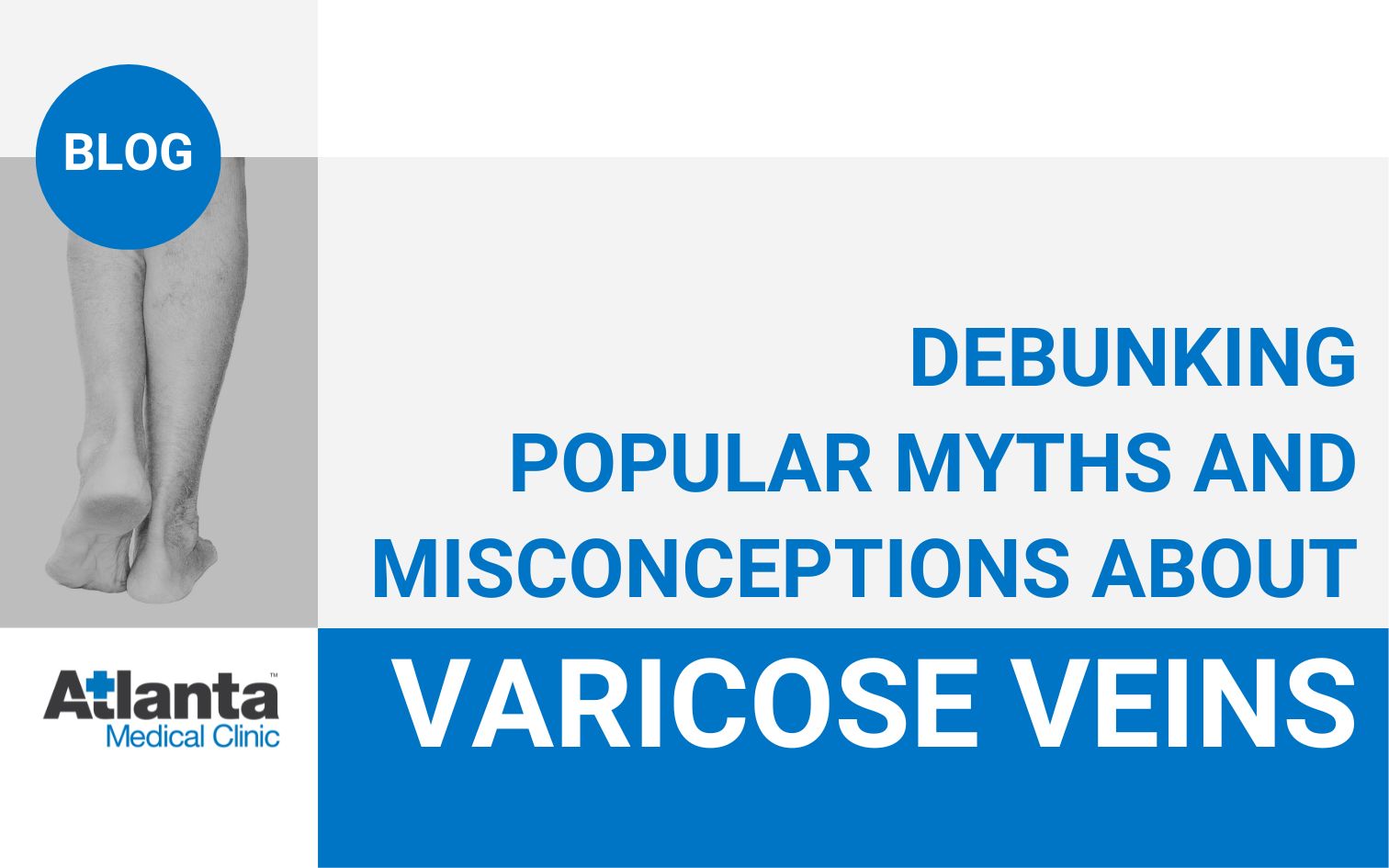 Blog Debunking Popular Myths and Misconceptions About Varicose Veins