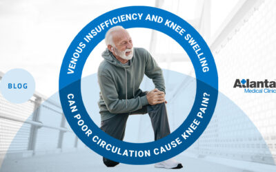 Venous Insufficiency and Knee Swelling: Can Poor Circulation Cause Knee Pain?