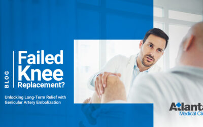 Failed Knee Replacement? Unlocking Long-Term Relief with Genicular Artery Embolization