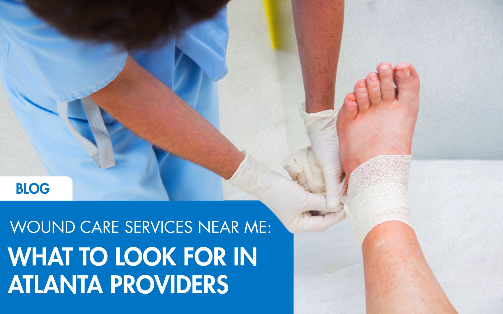 Wound Care Services Near Me: What to Look for in Atlanta Providers