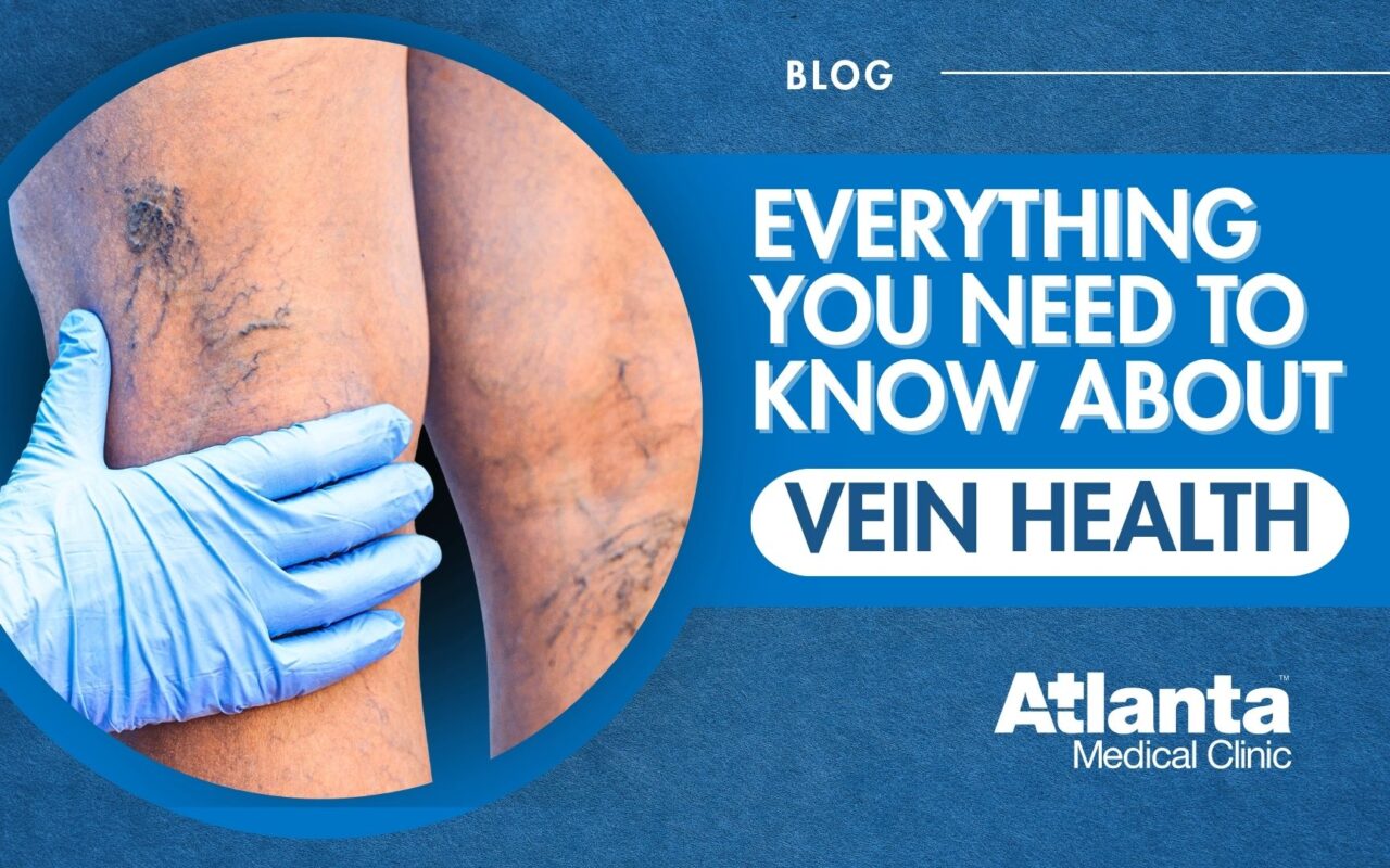 Vein Health Guide
